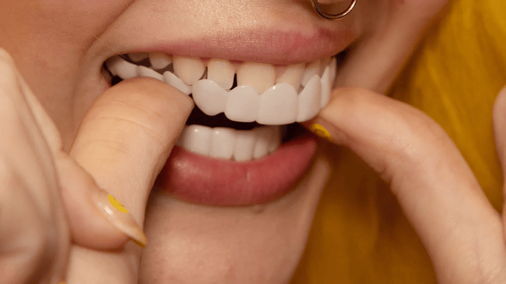 Evara | Removable Veneers for Upper & Lower
