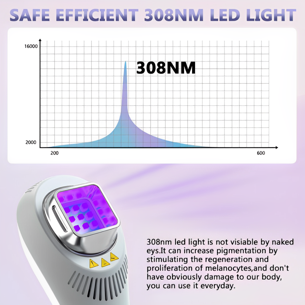 308 nm UVB Phototherapy Light for Vitiligo and Psoriasis