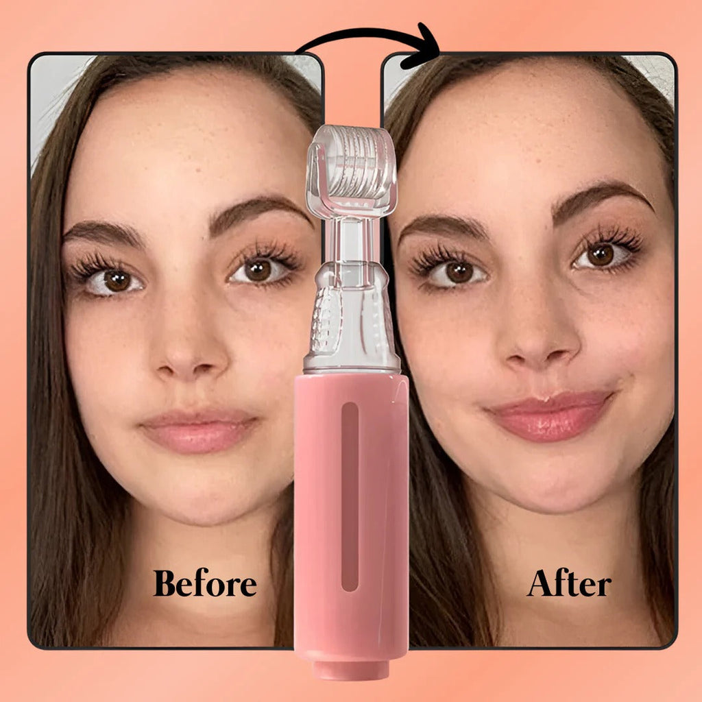 Lip Plumping Kit | Lip booster