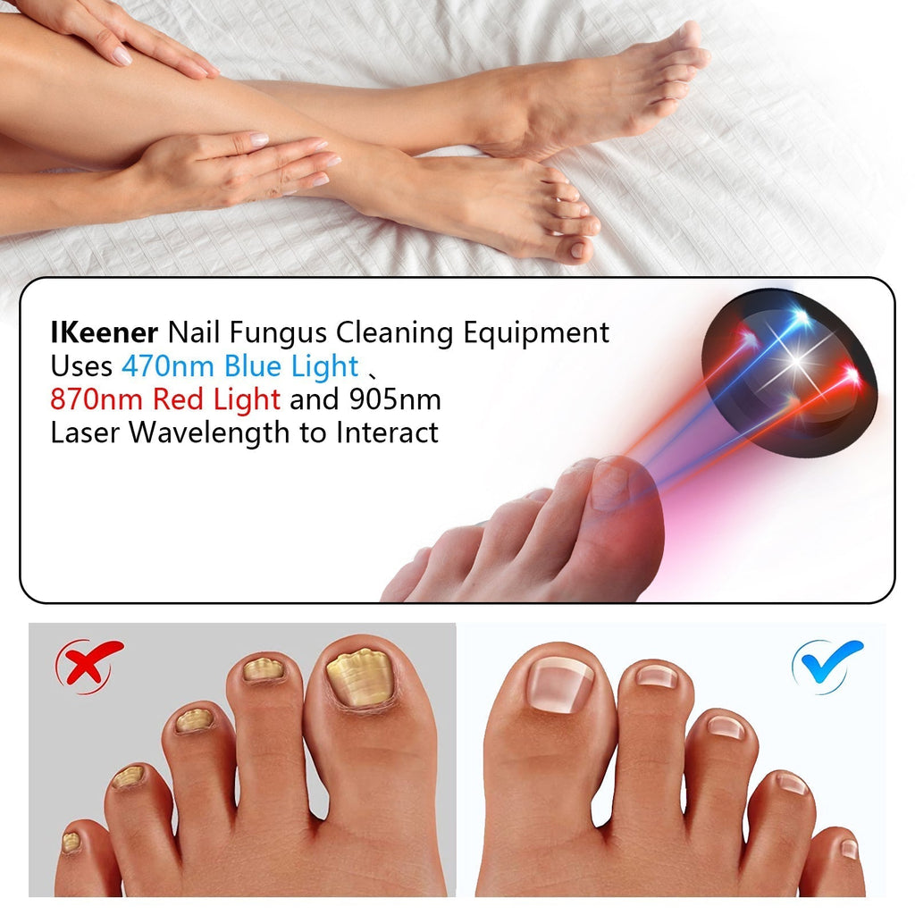 NailRevive | Laser Nail Fungus Care Device