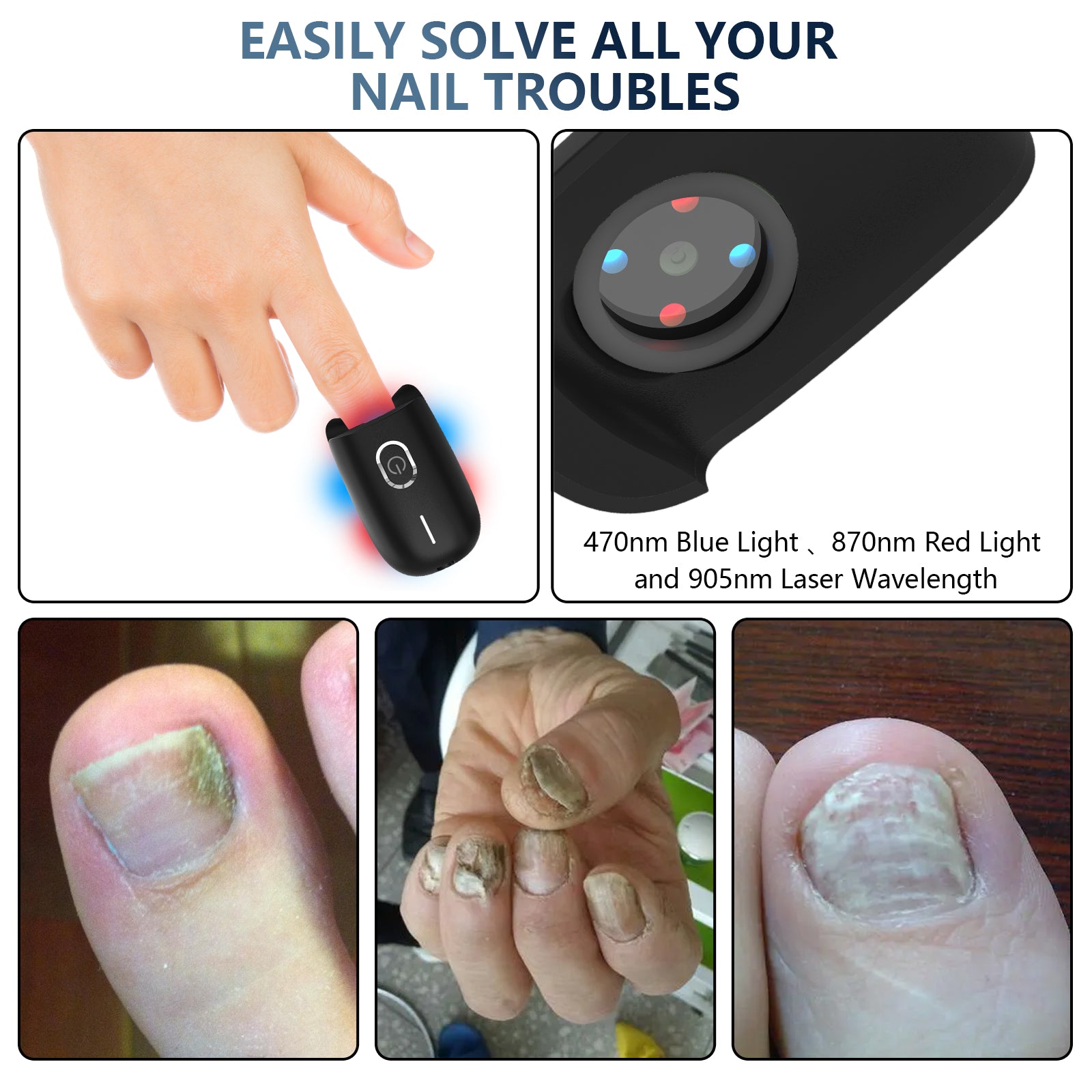 NailRevive | Laser Nail Fungus Care Device
