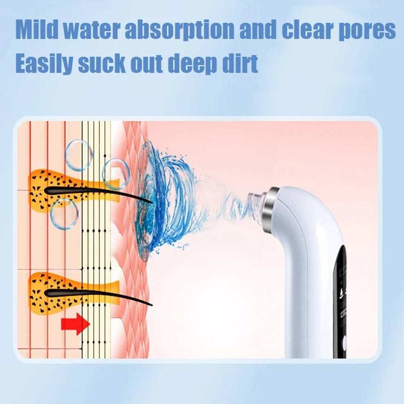 Advanced Blackhead Pore Vacuum