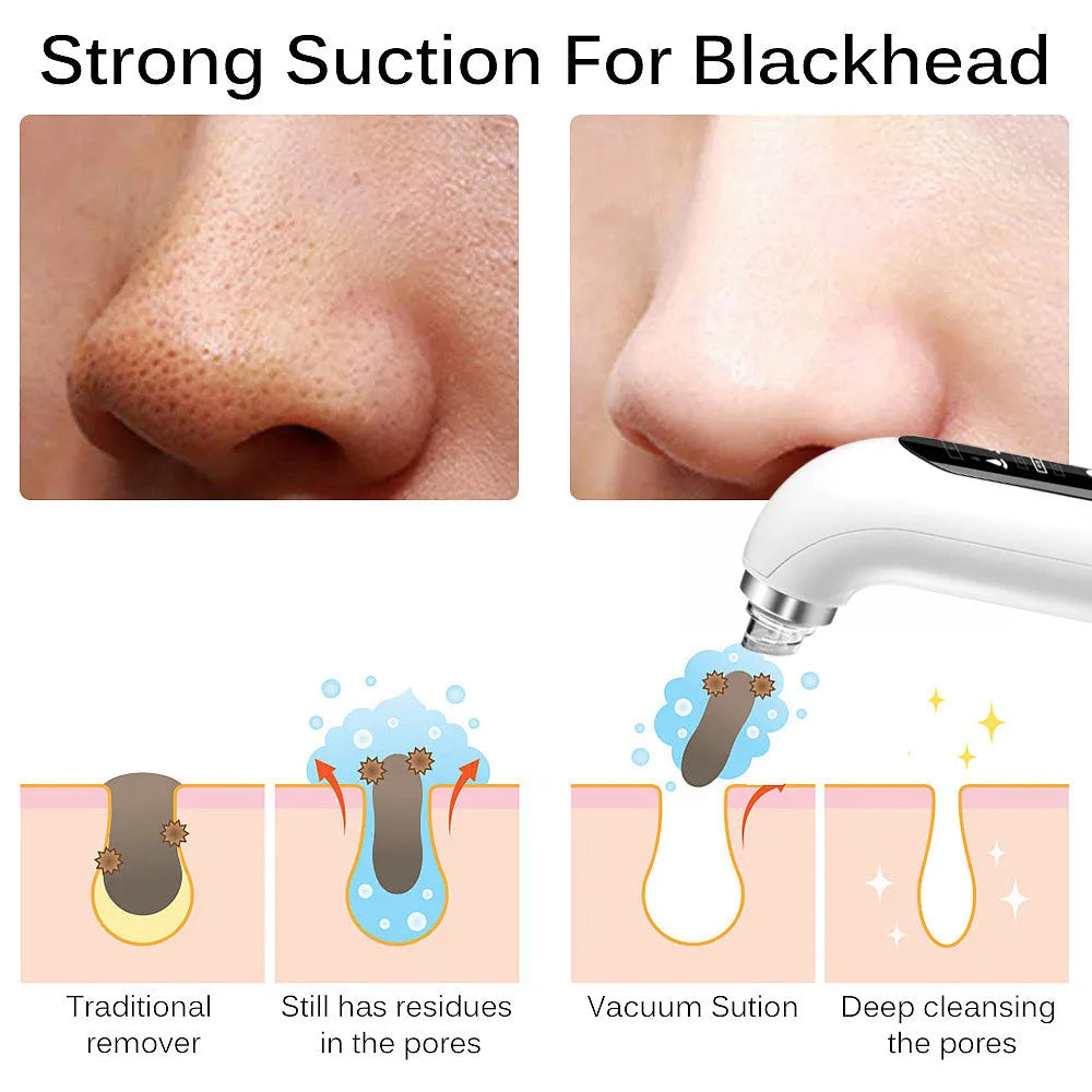 Advanced Blackhead Pore Vacuum